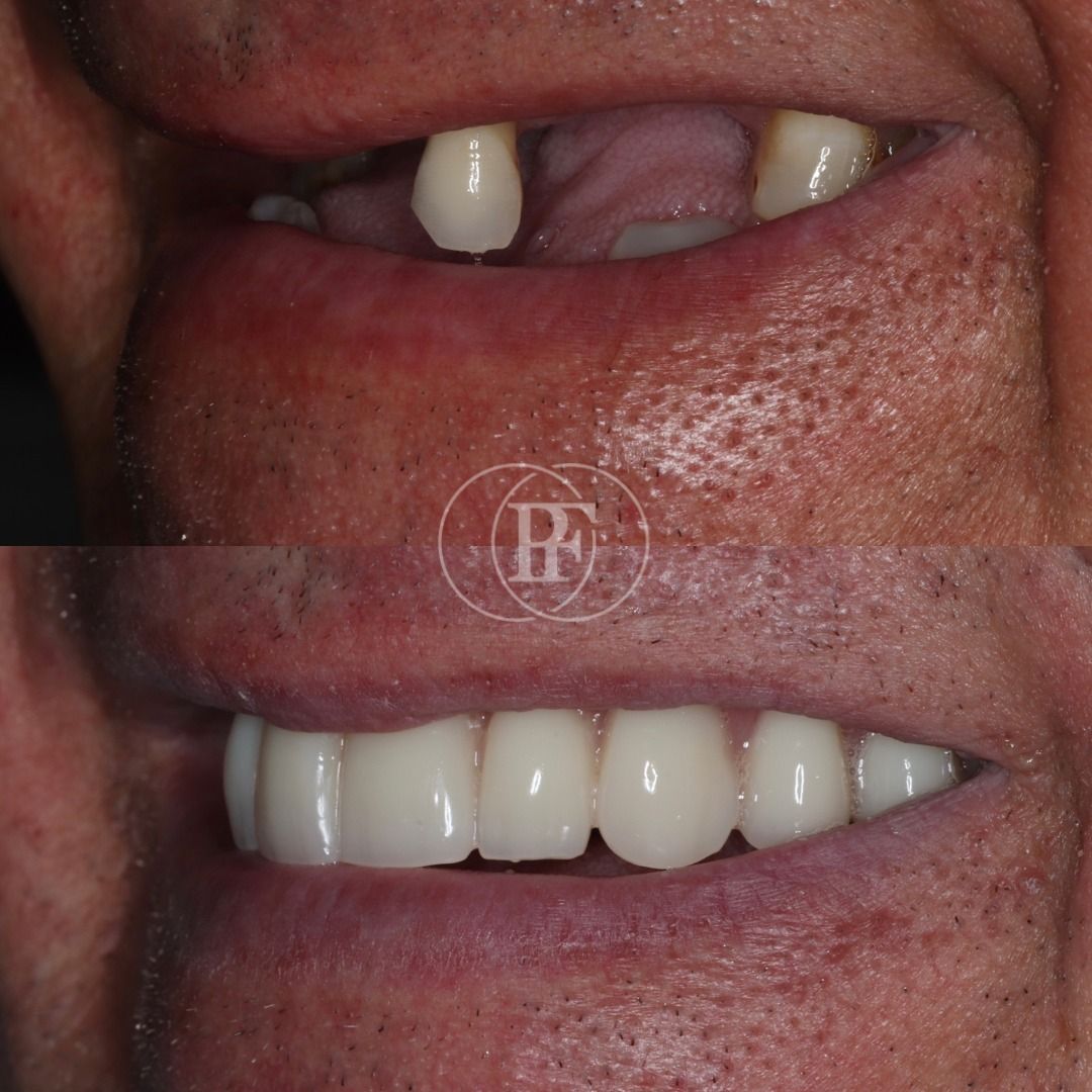 Treatment at the Pain Free Dentistry Group