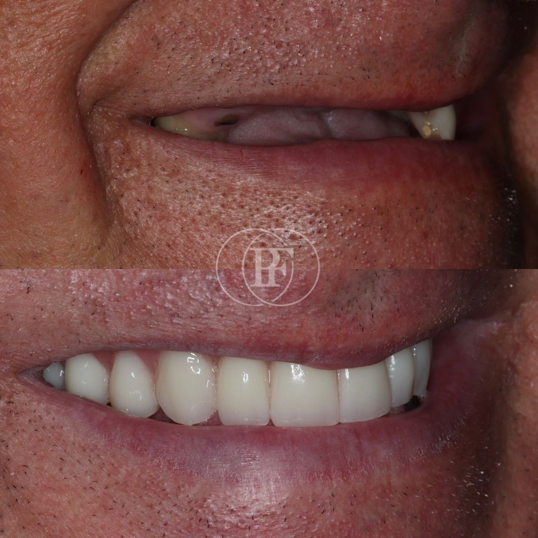 Treatment at the Pain Free Dentistry Group