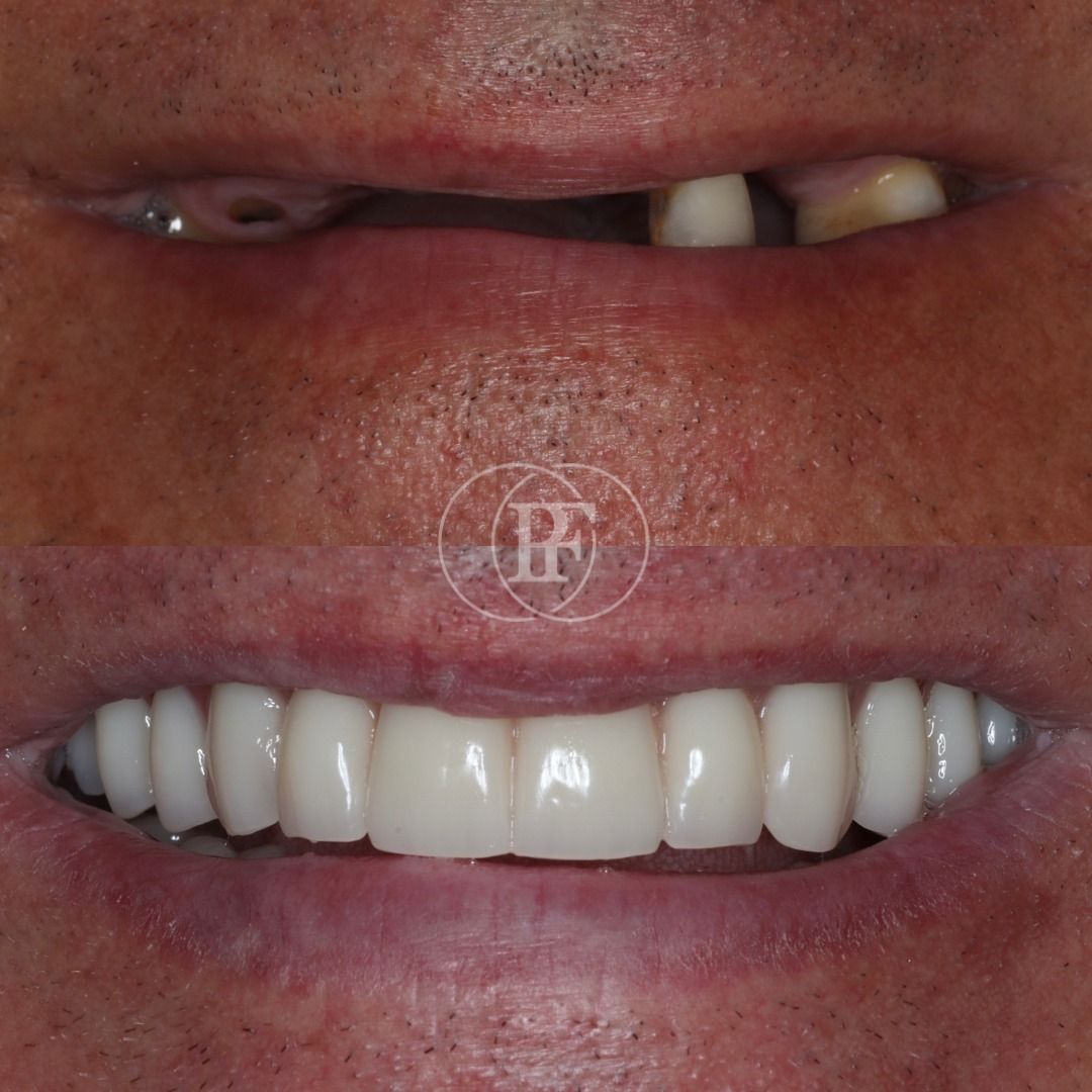 Treatment at the Pain Free Dentistry Group